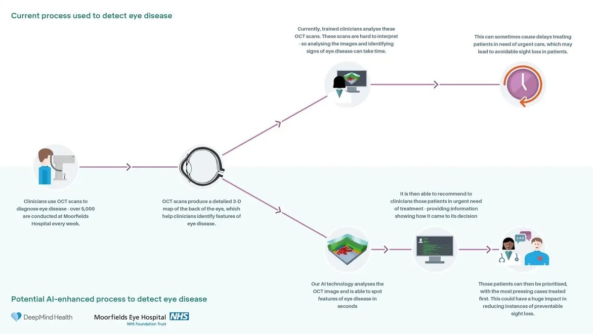 illustration of process used to detect eye disease